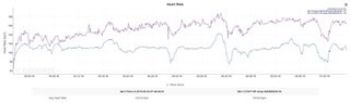 Work Cadence Examples HR data issues (works, but readings are faulty) - post your examples ...