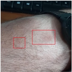 watch mainly worn on right red square. i switched after realising my skin was flaking off.