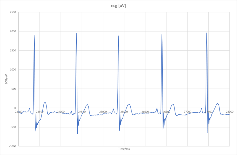 Polar H10 ECG plot