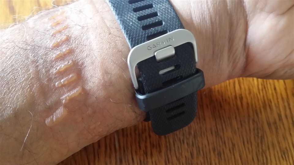 garmin bicep strap