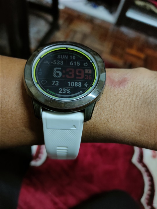 Garmin vivoactive 3 sales rash